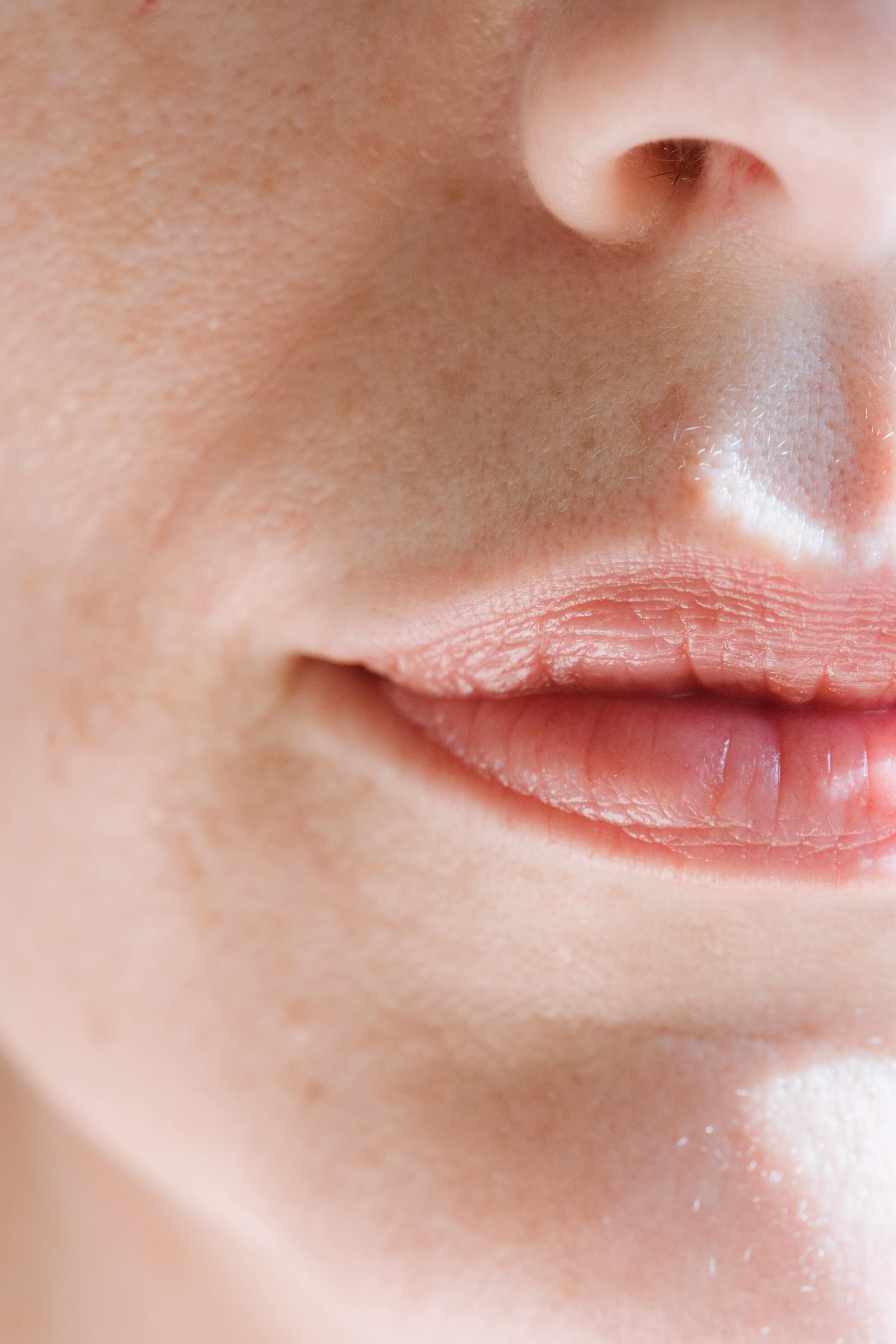 traitement herpes labial